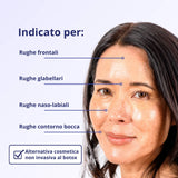 LELANG BOTOXIL Siero viso